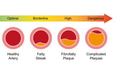 How Can You Improve Arterial Health Naturally?