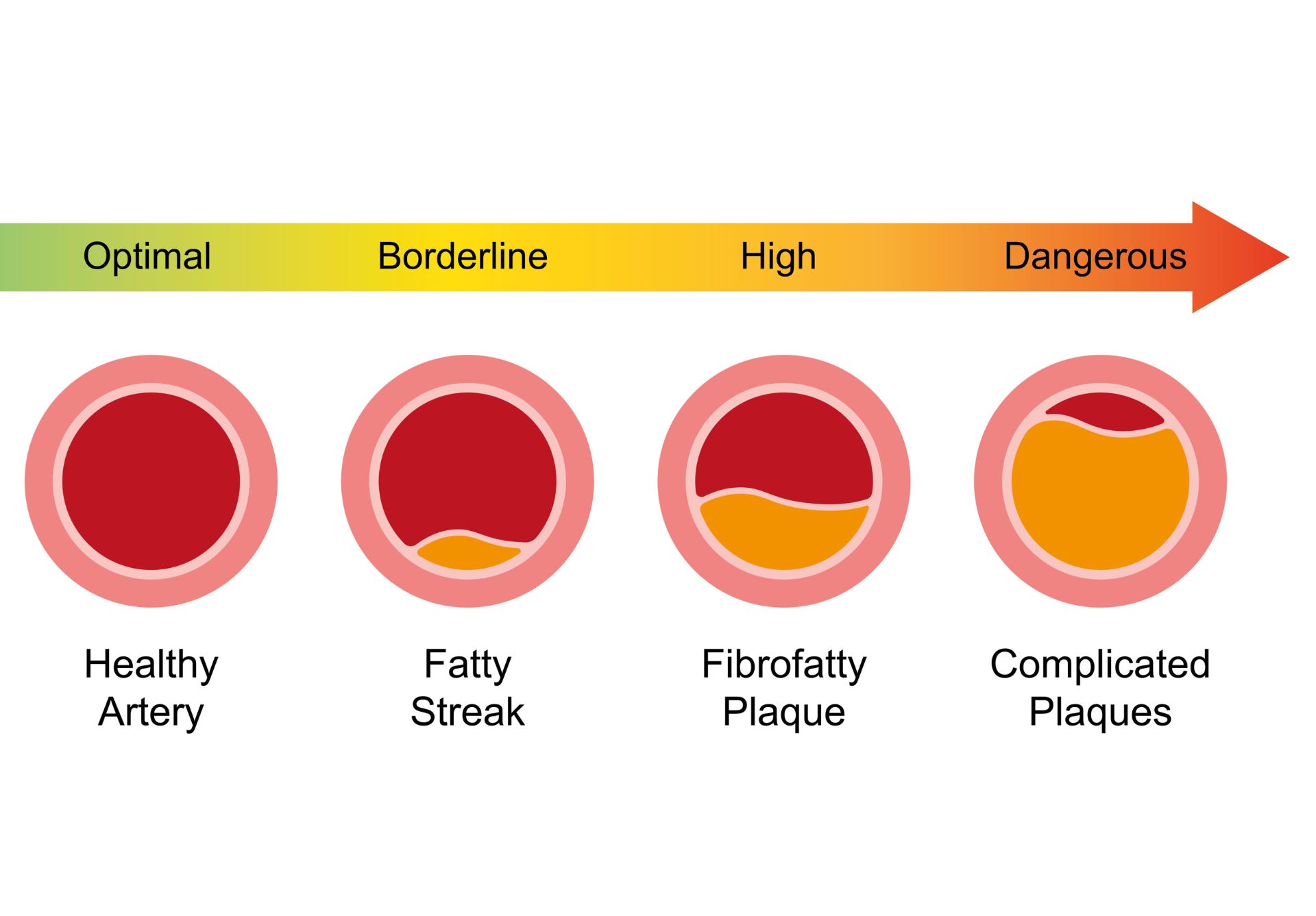 How Can You Improve Arterial Health Naturally?